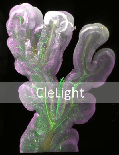 Cerebellum_CleLight